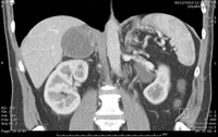 Adrenal Photo Gallery