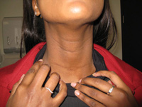 Thyroid Photo Gallery