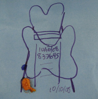 Parathyroid Photo Gallery