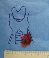 Parathyroid Photo Gallery