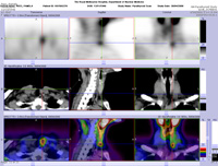 Parathyroid Photo Gallery