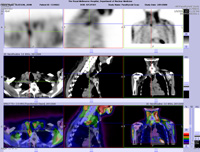 Parathyroid Photo Gallery