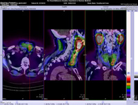 Parathyroid Photo Gallery