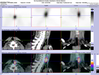 Parathyroid Photo Gallery