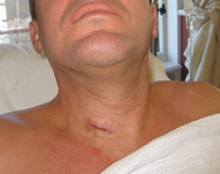 Parathyroid Photo Gallery