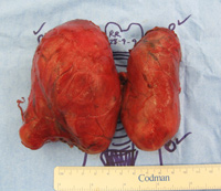 Thyroid Photo Gallery