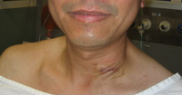 Parathyroid Photo Gallery