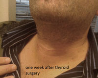 Thyroid Photo Gallery